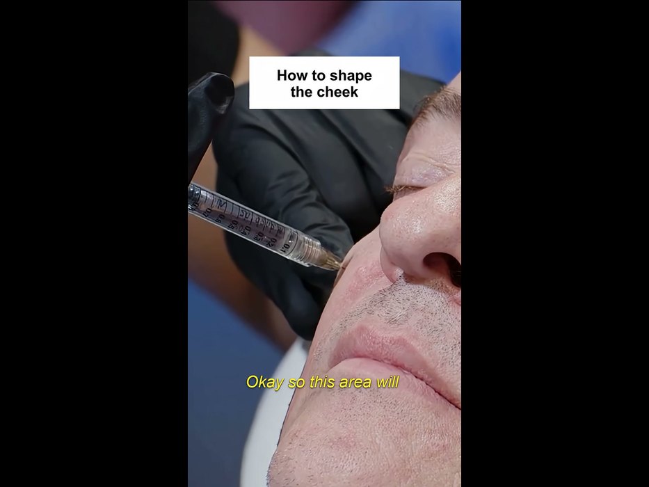 고객 채널 쇼츠의 첫 장면. 같은 주사 장면과 'How to shape the cheek' 제목, 노란 자막